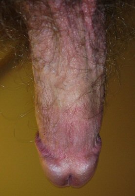 Multiple 2: hairy shaft